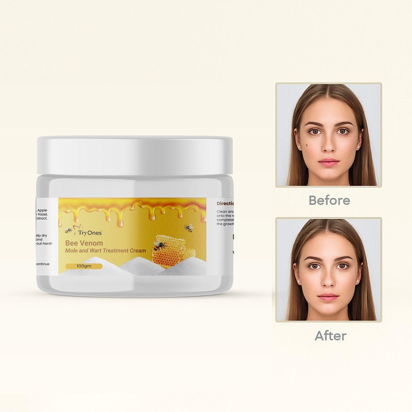 Bee Venom Mole and Wart Treatment Cream 200 gm Pack of 2 - shops-home.com