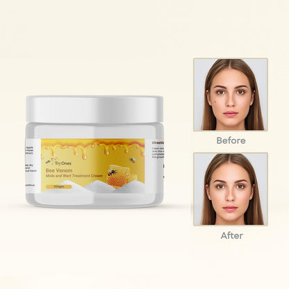 Bee Venom Mole and Wart Treatment Cream 200 gm Pack of 2 - shops-home.com